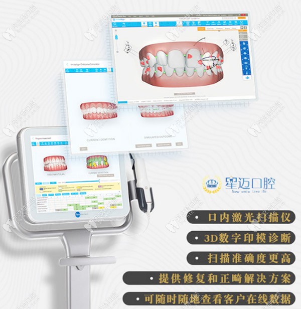 iTero口掃設(shè)備的特點 iTero口掃設(shè)備的特點