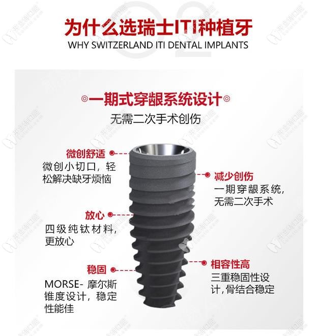 瑞士iti士卓曼種植體好嗎？