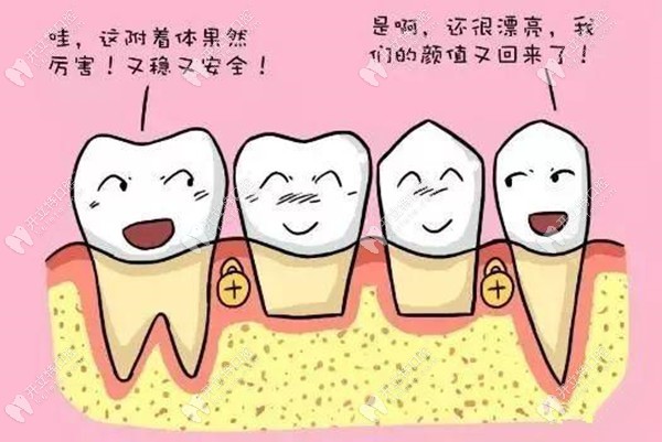 吸附性牙齒的優(yōu)點