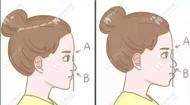 這項(xiàng)技術(shù)針對國內(nèi)凸面畸形