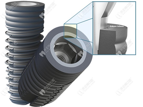 CLC種植體支持美學修復