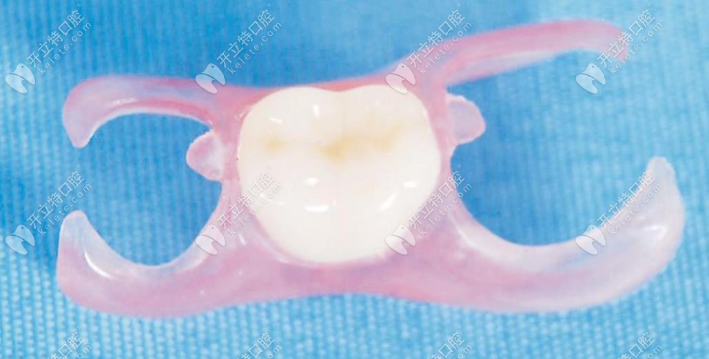 少一顆牙有幾種方法修復,年輕人鑲活動和固定假牙哪種好？