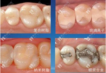不同樹脂材料類型及價(jià)格