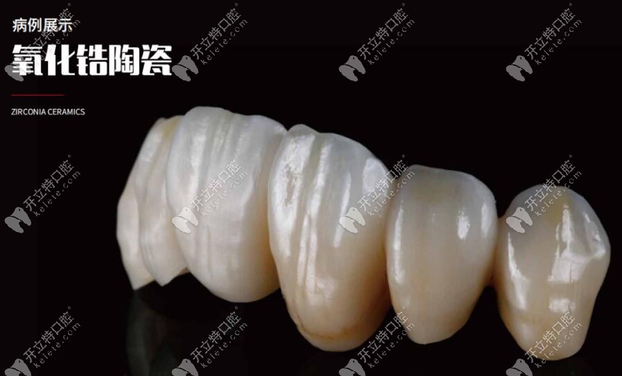 愛爾創(chuàng)全瓷牙冠美學(xué)修復(fù)